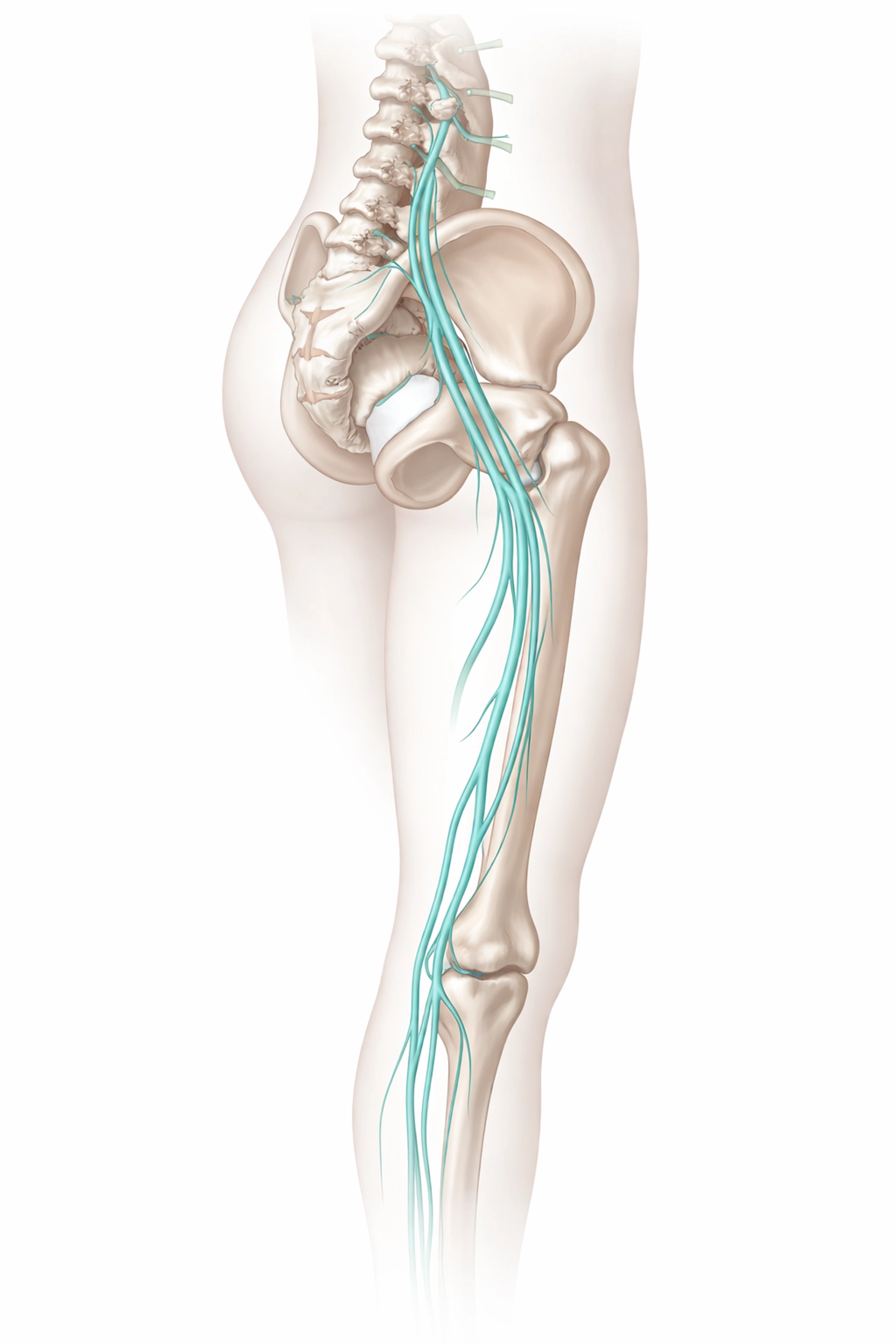 Illustration of sciatic nerve pathway from lower spine through pelvis and down the leg